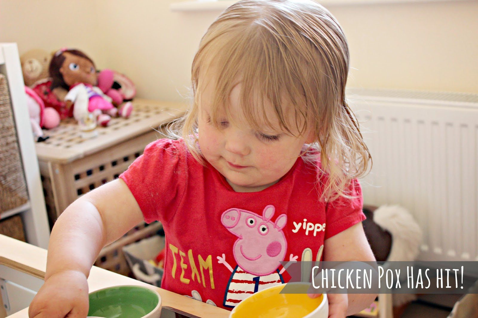 Chicken Pox Has Hit!