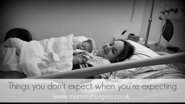 Things you don’t expect when you’re expecting